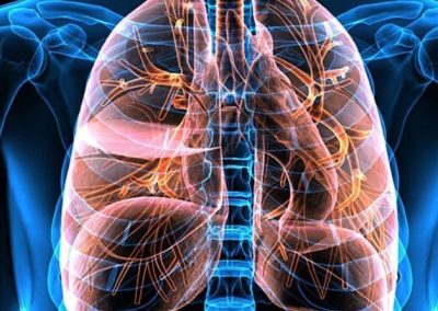 Immuno oncologia nel trattamento del carcinoma polmonare. Esperienze di pratica clinica a confronto – Milano (MI) 11 Giugno 2022