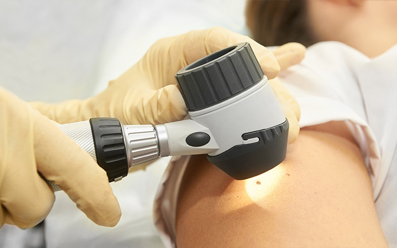 NUOVE PROSPETTIVE NEL TRATTAMENTO DEL MELANOMA CUTANEO – II INCONTRO GRUPPO ATNO MELANOMA – Livorno (LI) 15 Marzo 2024