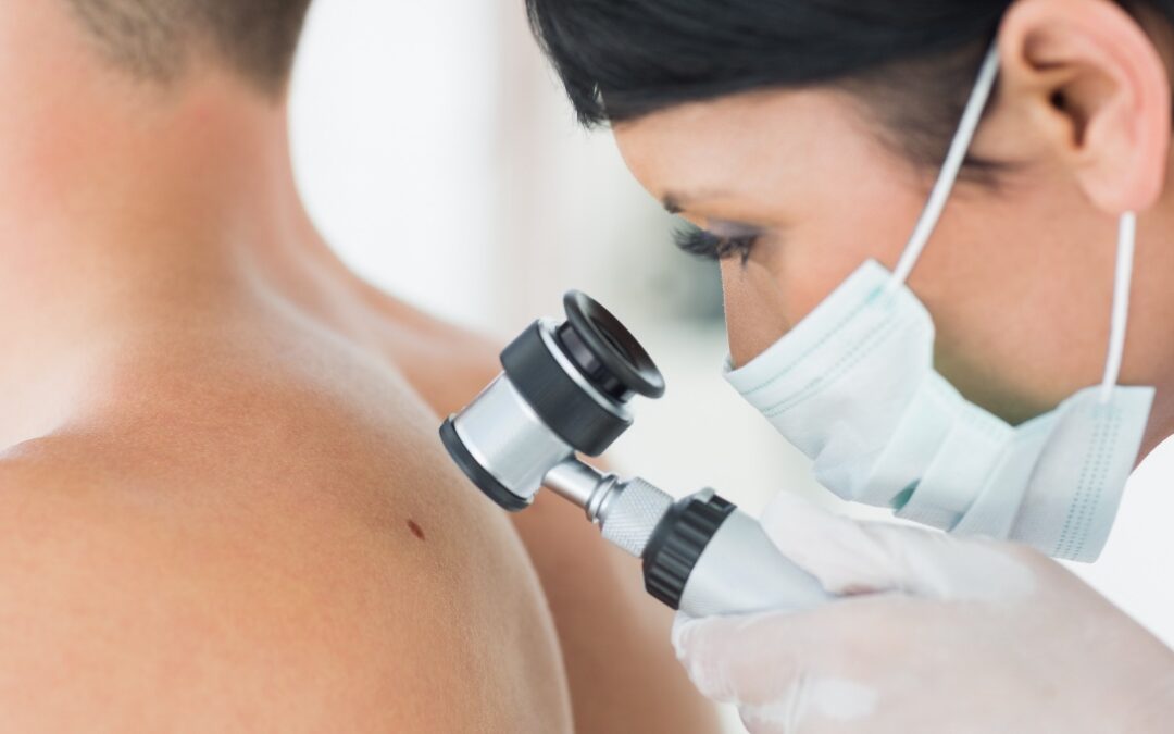 L’IMMUNOTERAPIA ED IL MELANOMA IN ABRUZZO – Francavilla al Mare (CH) 11 Aprile 2024