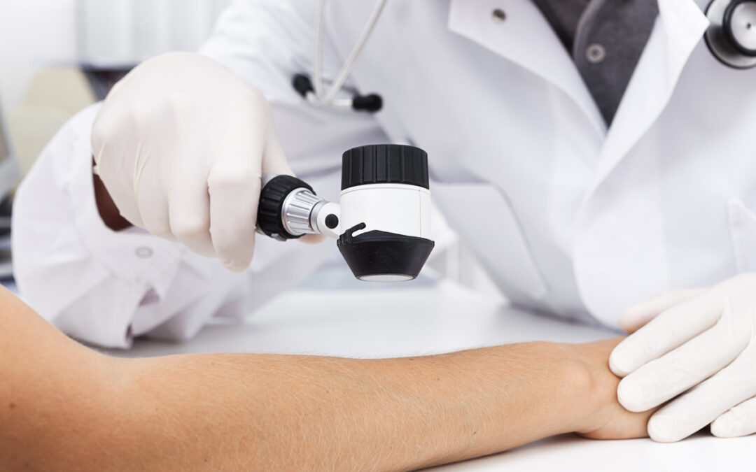 NUOVE PROSPETTIVE NELLA TERAPIA MEDICA DEL MELANOMA – III EDIZIONE – Bari (BA) 18 Maggio 2024