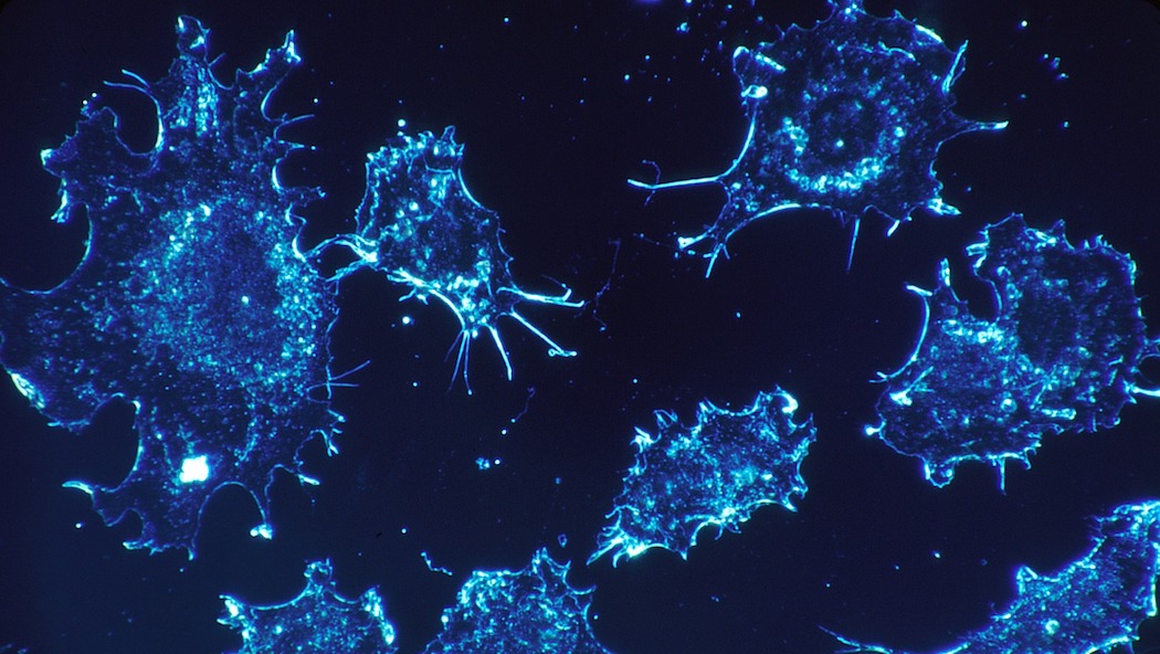 Immunoterapia nel NSCLC avanzato: dagli studi clinici alla real-world evidence – Milano (MI) 4 Aprile 2025