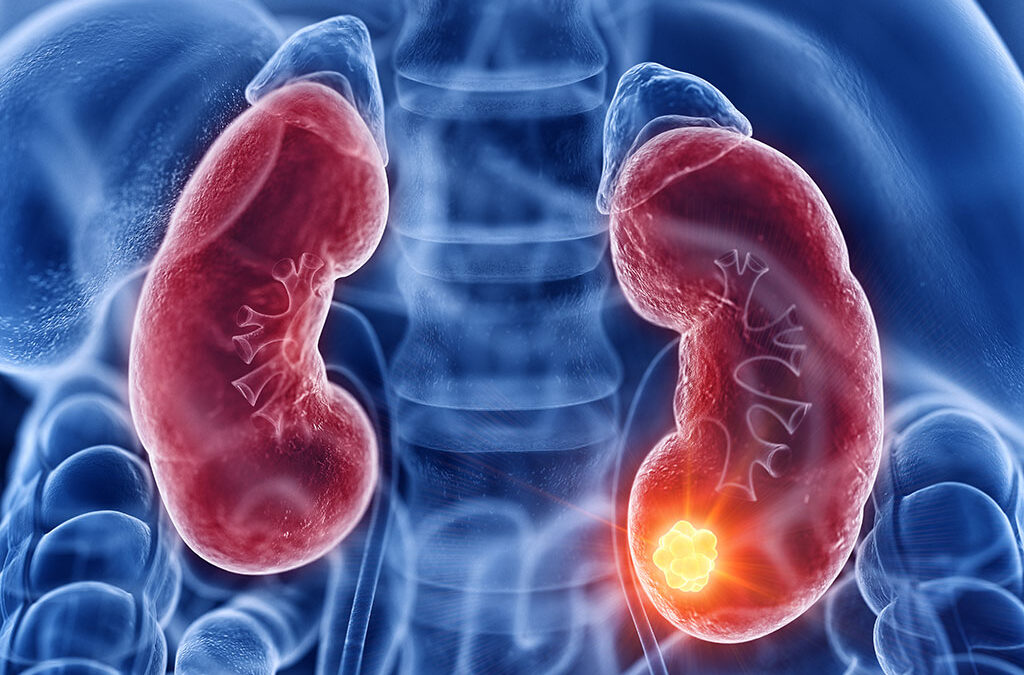 First-line treatment for patients with metastatic renal cell carcinoma: how to choose the best option for our patients? II Edition – Parma (PR) 8 Ottobre 2024